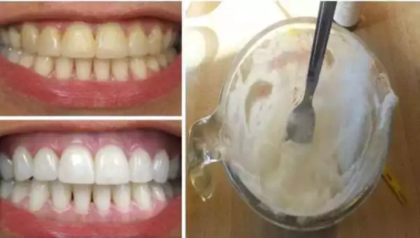 This Amazing 2 Ingredients Will Naturally Whiten Your Teeth
